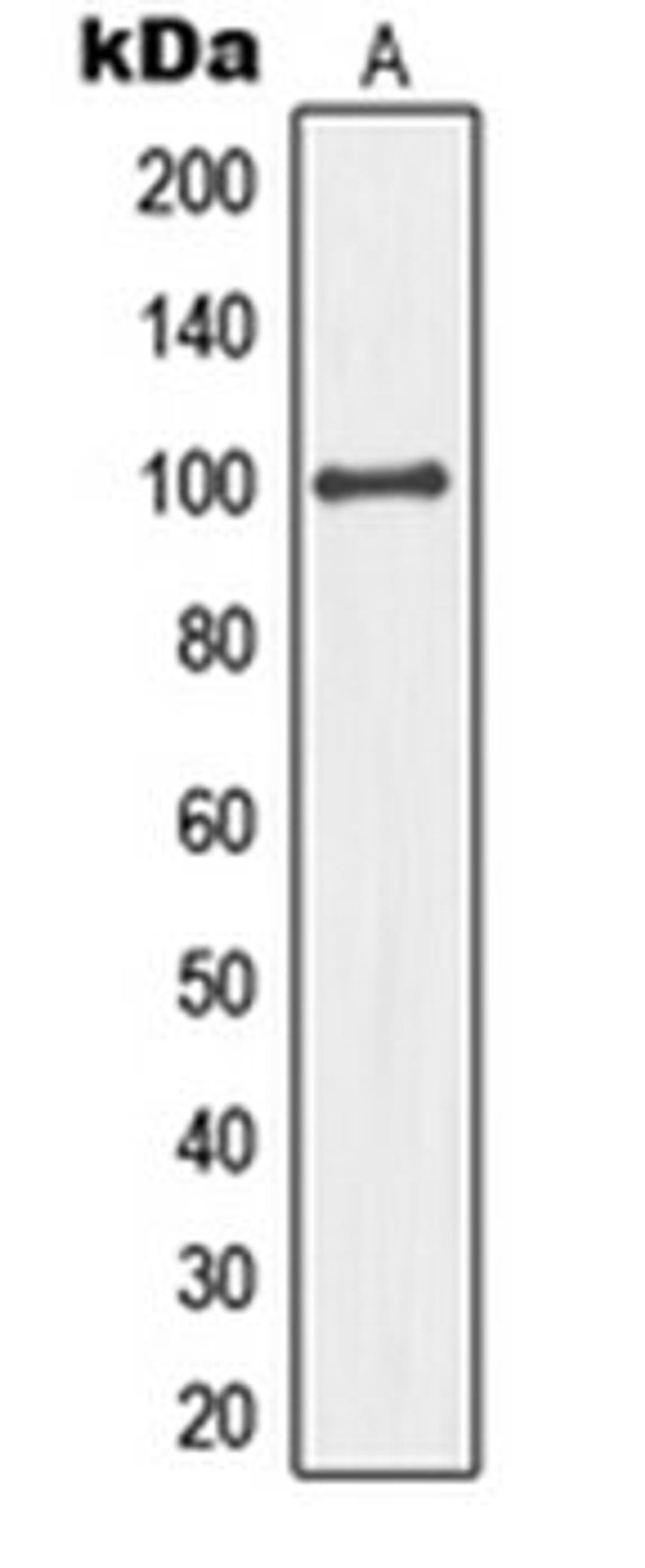 Western blot analysis of HeLa (Lane 1) whole cell lysates using MCM4 antibody