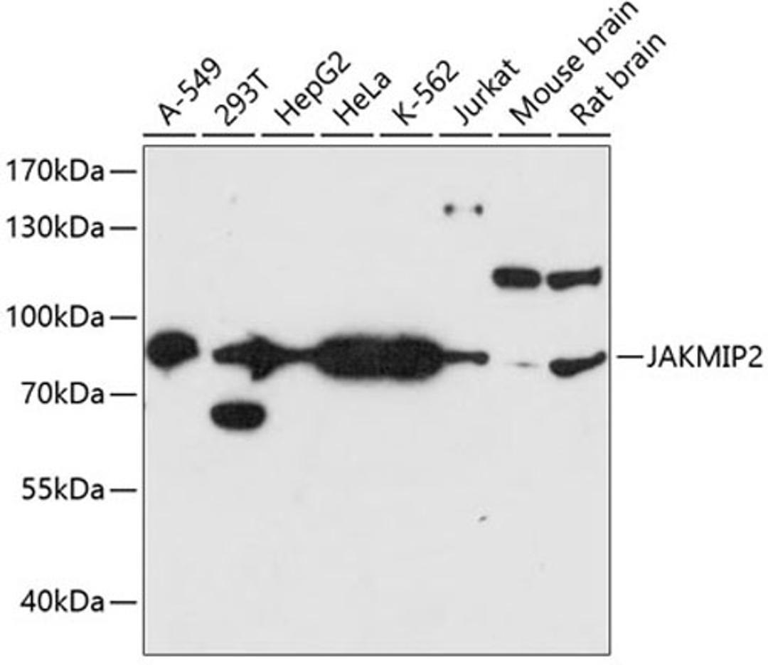 Western blot - JAKMIP2 antibody (A14387)