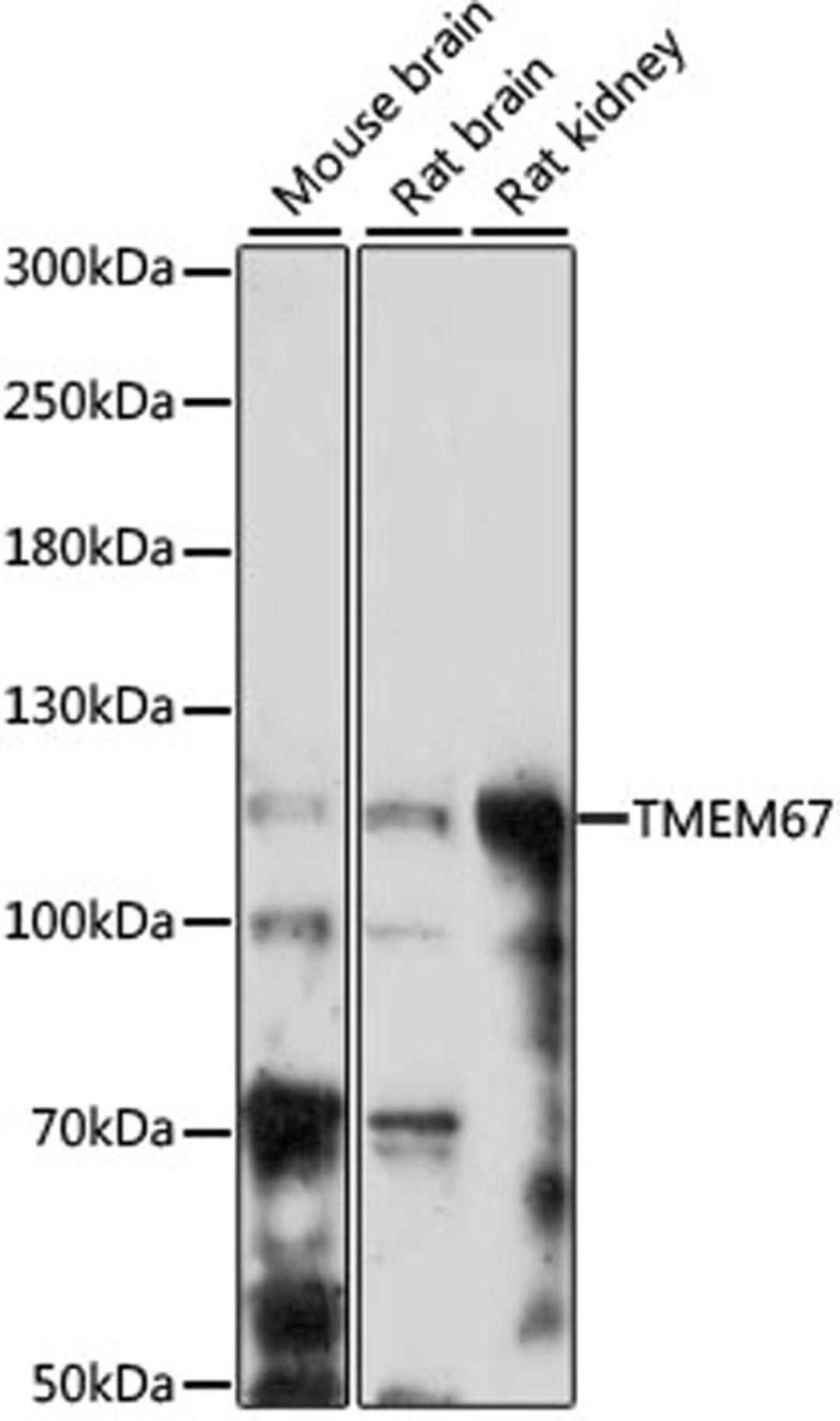 Western blot - TMEM67 antibody (A15549)