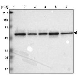 Western Blot: TOM1 Antibody [NBP1-86170] - Lane 1: Marker [kDa] 207, 110, 79, 49, 32, 25, 17<br/>Lane 2: Human cell line RT-4<br/>Lane 3: Human cell line EFO-21<br/>Lane 4: Human cell line A-431<br/>Lane 5: Human liver tissue<br/>Lane 6: Human tonsil tissue