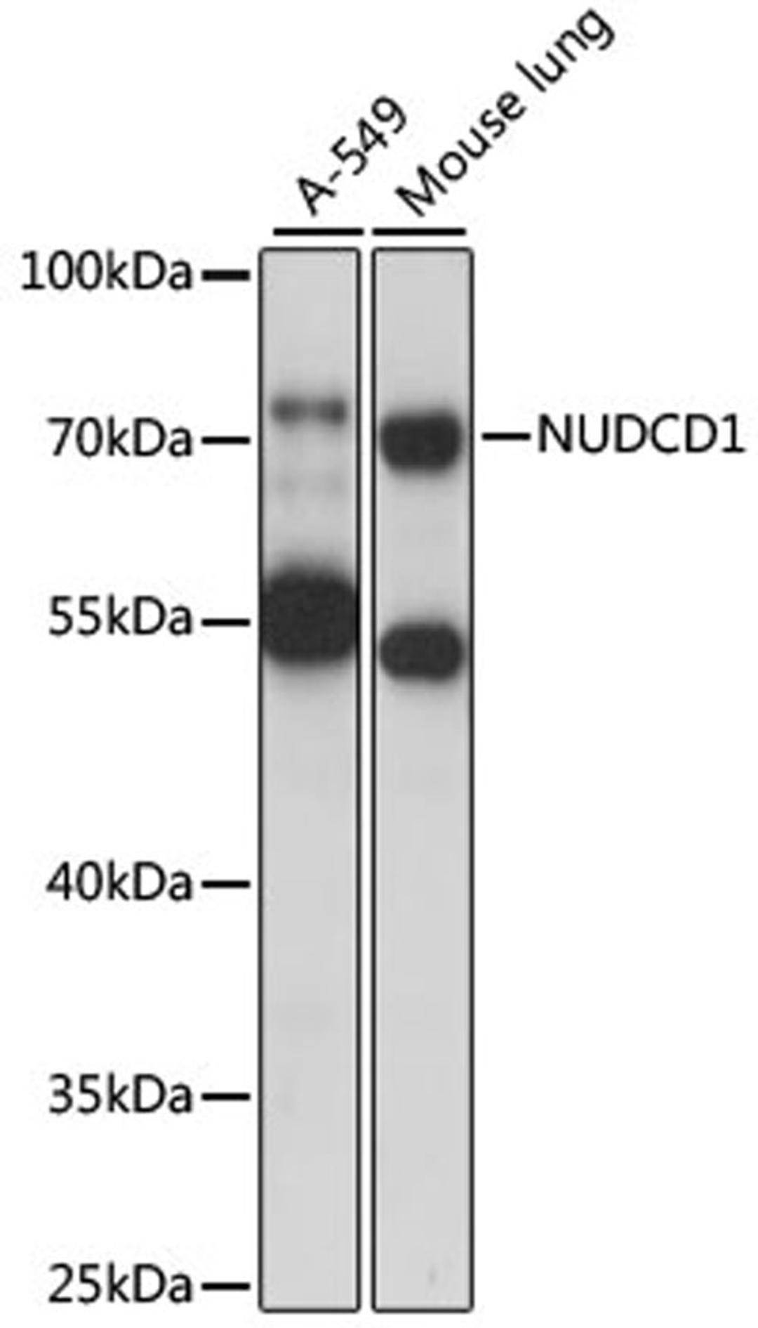 Western blot - NUDCD1 antibody (A15919)