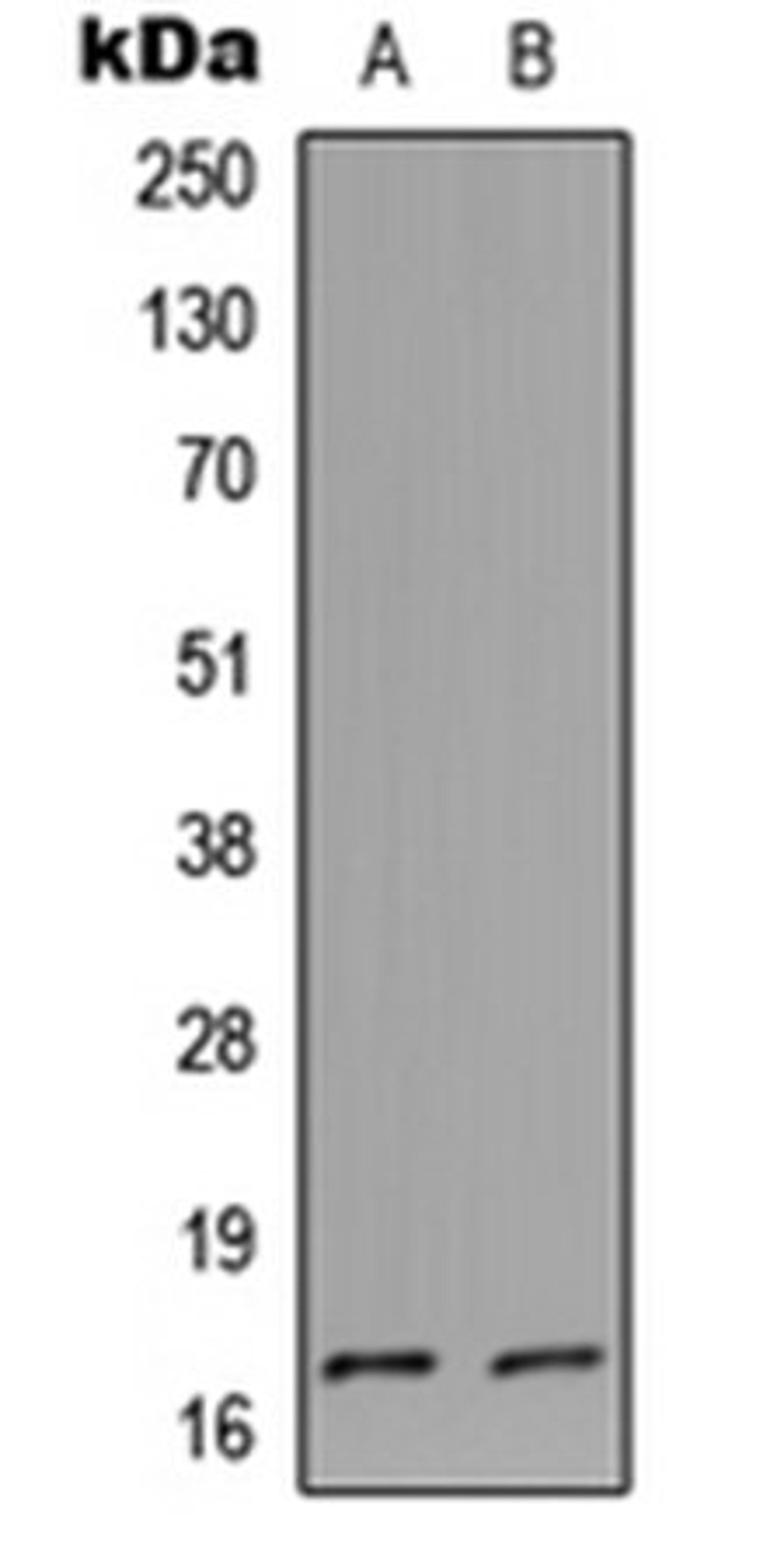 Western blot analysis of HeLa (Lane1), PC12 (Lane2) whole cell using Cystatin L1 antibody