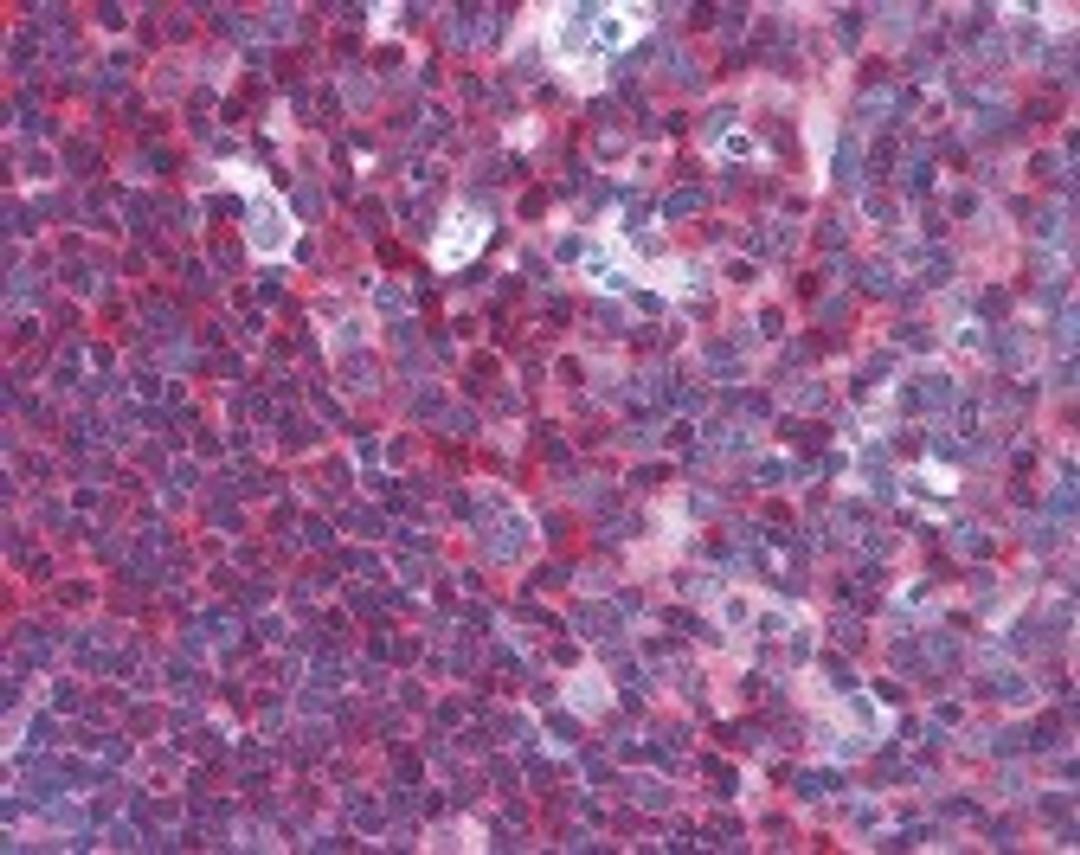 Immunohistochemistry staining of NFKB1 in tonsil tissue using NFKB1 monoclonal Antibody.