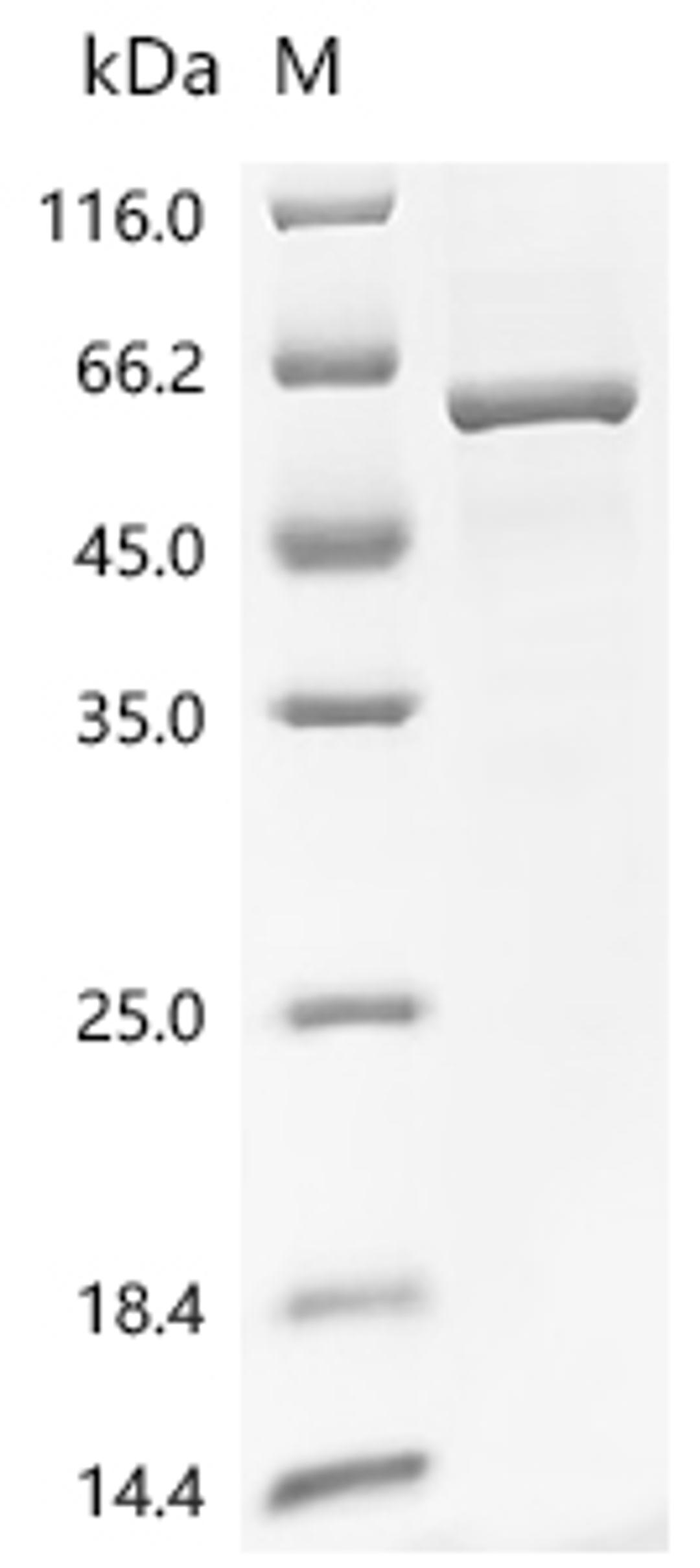 (Tris-Glycine gel) Discontinuous SDS-PAGE (reduced) with 5% enrichment gel and 15% separation gel.