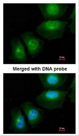 Immunocytochemistry/Immunofluorescence: S100A11 Antibody [NBP1-32998] - Analysis of paraformaldehyde-fixed HeLa, using NBP1-32998.