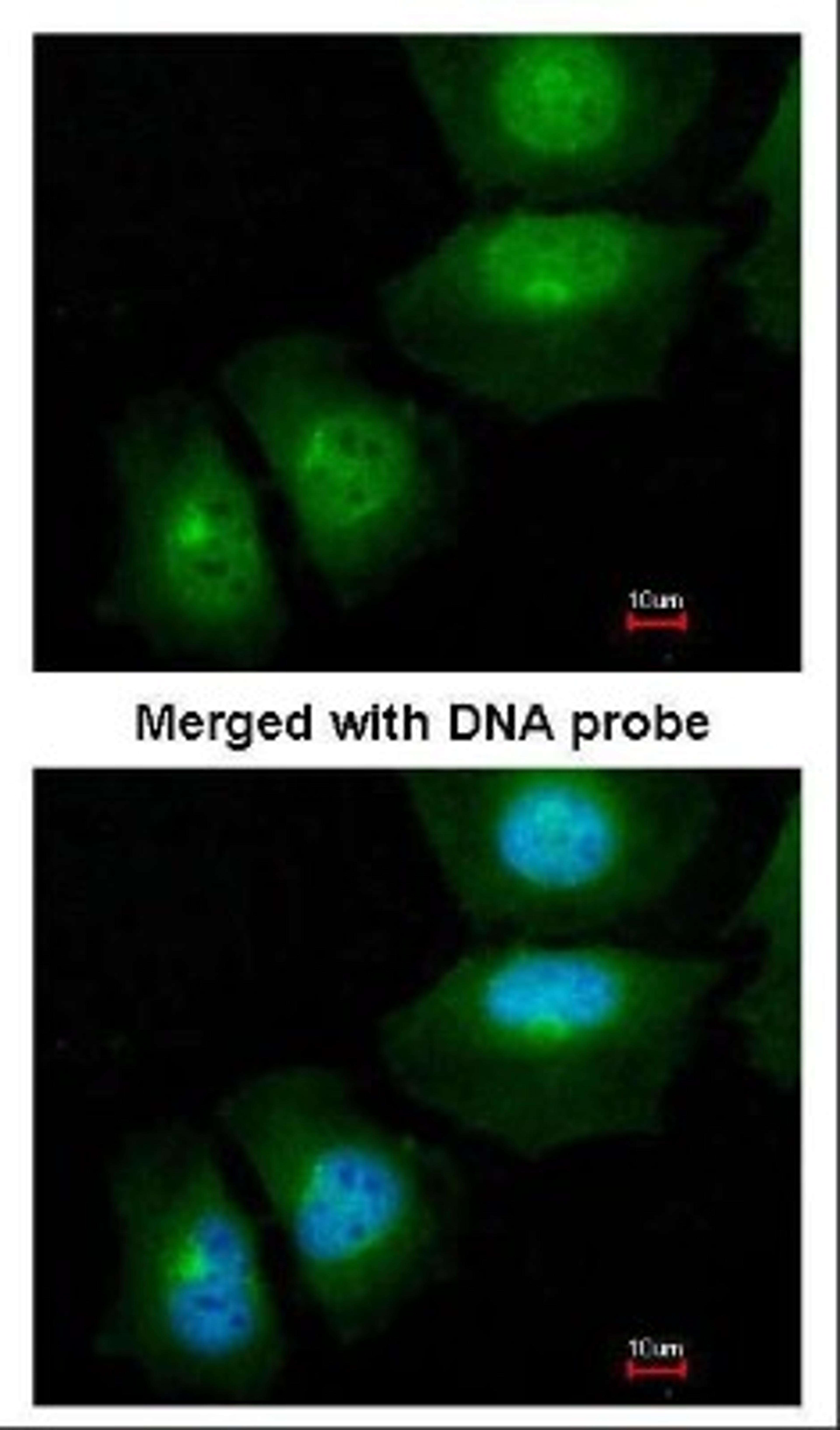 Immunocytochemistry/Immunofluorescence: S100A11 Antibody [NBP1-32998] - Analysis of paraformaldehyde-fixed HeLa, using NBP1-32998.