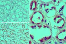 Immunohistochemistry-Paraffin: Furin Antibody [NBP2-24687] - analysis of Furin in formalin-fixed, paraffin-embedded human kidney tissue using an isotype control (top left) and this antibody (bottom left, right) at 5 ug/ml.