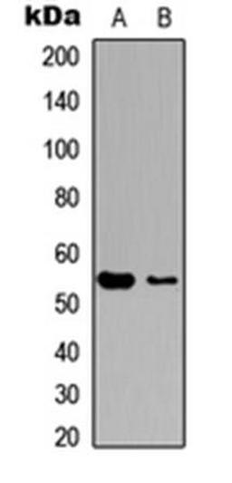 Western blot analysis of HeLa (Lane1), NIH3T3 (Lane2) whole cell using MEF2C antibody