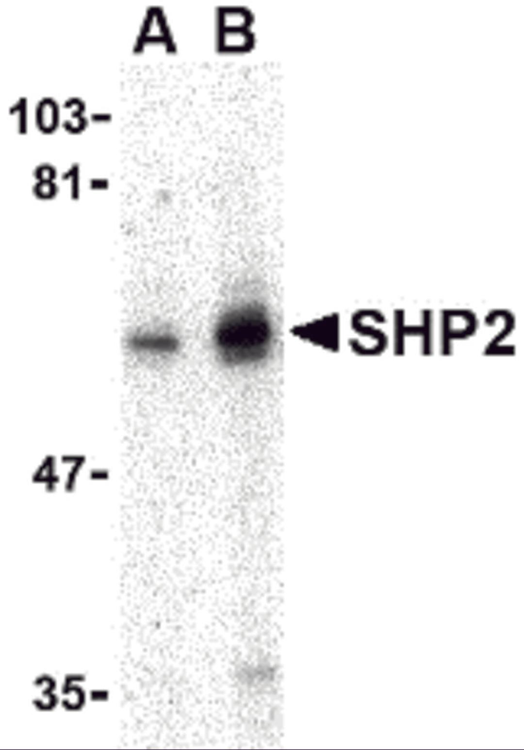 Western blot analysis of SHP2 in mouse skeletal muscle tissue lysate with SHP2 antibody at (A) 0.5 and (B) 1 μg/mL.