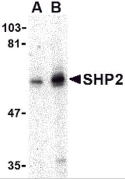 Western blot analysis of SHP2 in mouse skeletal muscle tissue lysate with SHP2 antibody at (A) 0.5 and (B) 1 μg/mL.