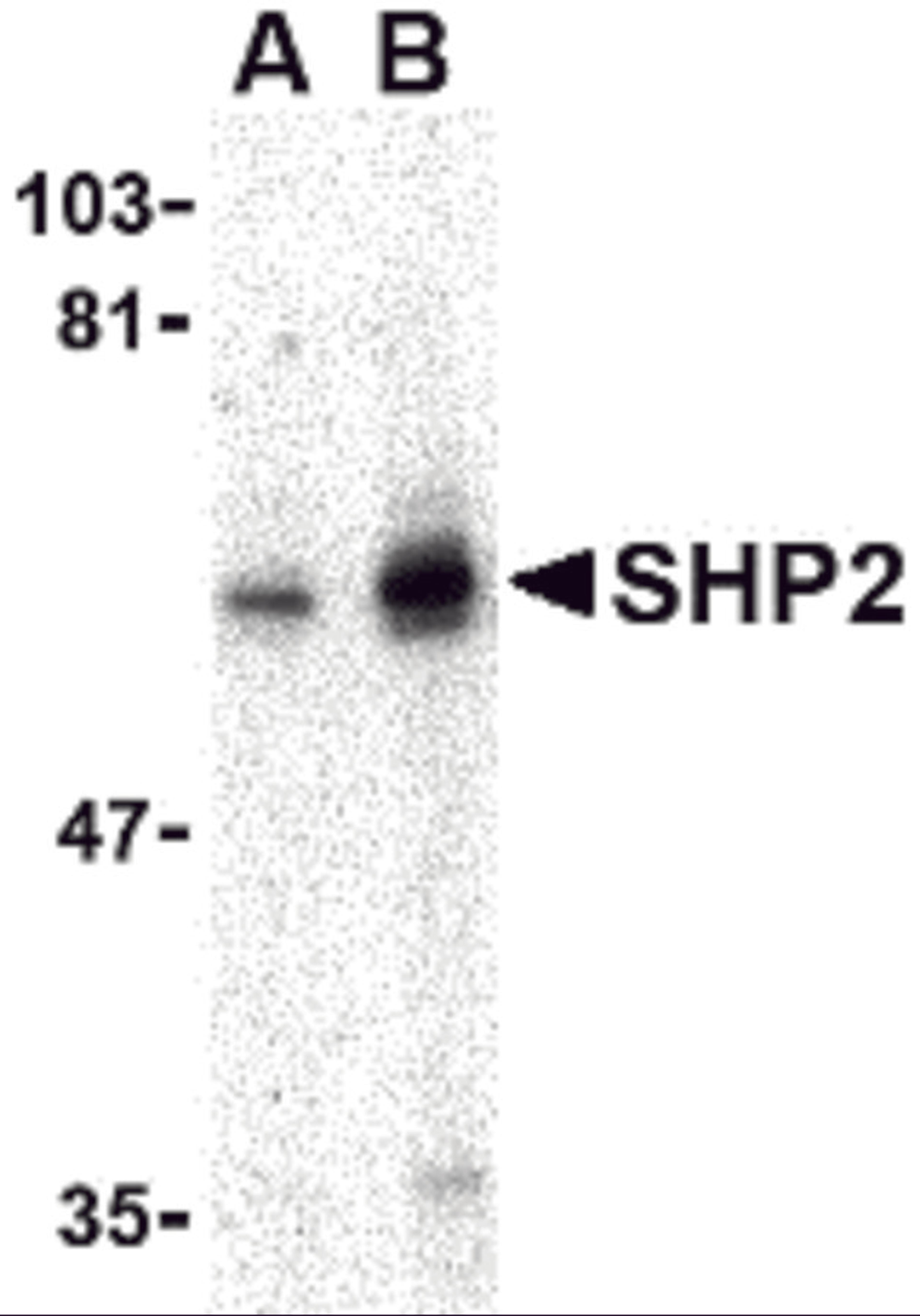 Western blot analysis of SHP2 in mouse skeletal muscle tissue lysate with SHP2 antibody at (A) 0.5 and (B) 1 μg/mL.