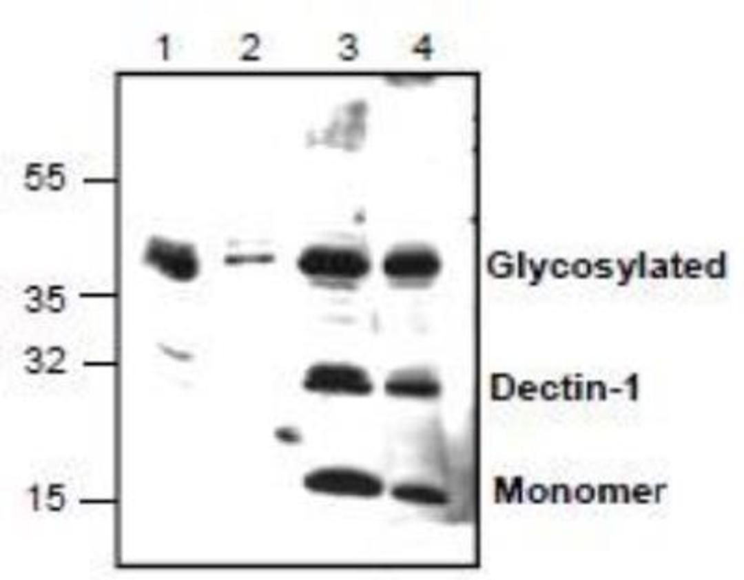 Western Blot: Dectin-1/CLEC7A Antibody [NBP1-45514] - Analysis of Dectin-1 expression in lysate from rat kidney (Lane 1), 3T3 cells (Lane 2) and Jurkat cells (Lane 3 & 4).