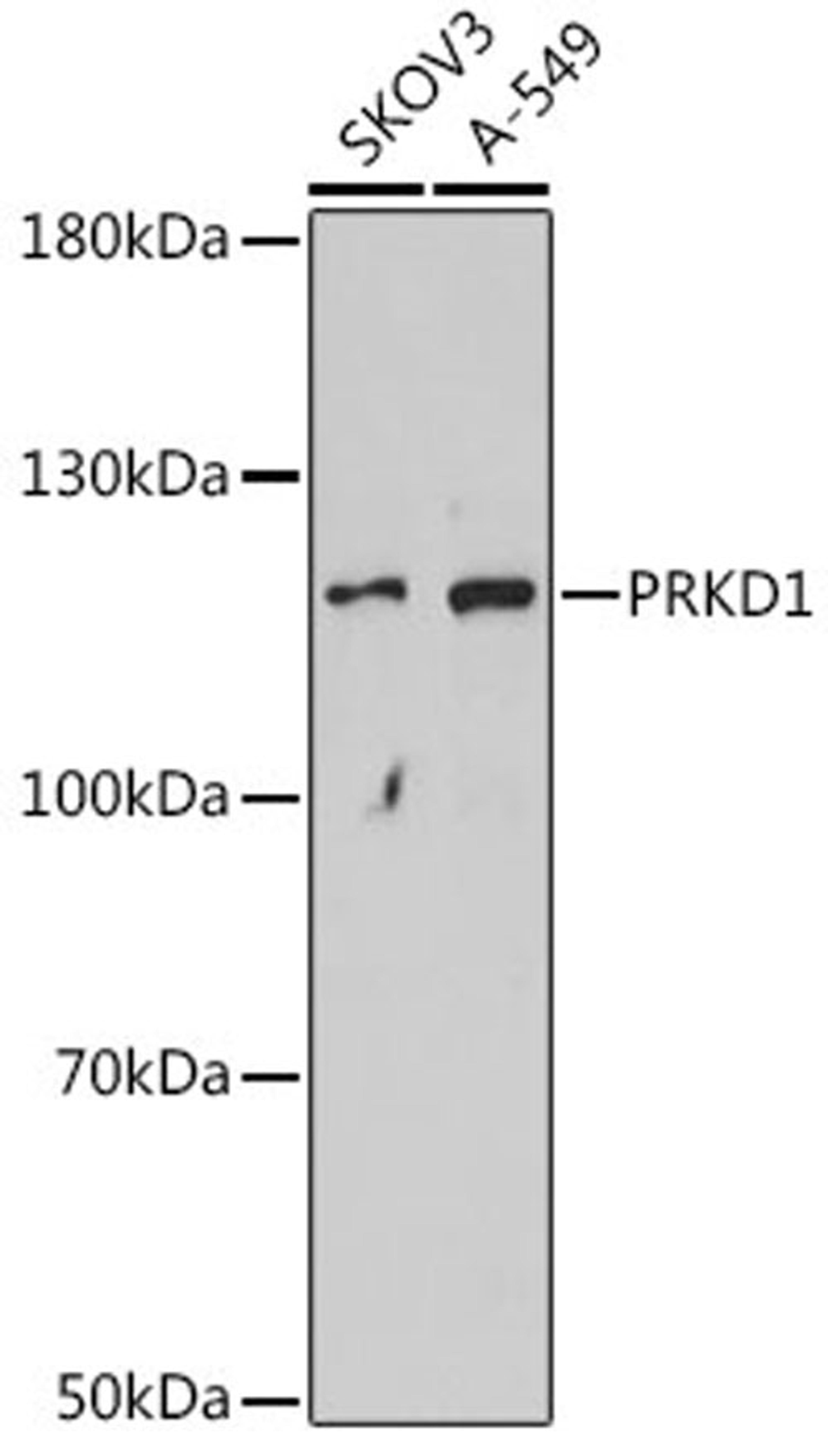 Western blot - PRKD1 antibody (A16185)