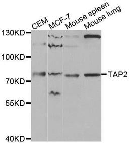 Western blot analysis of extracts of various cell lines using TAP2 antibody