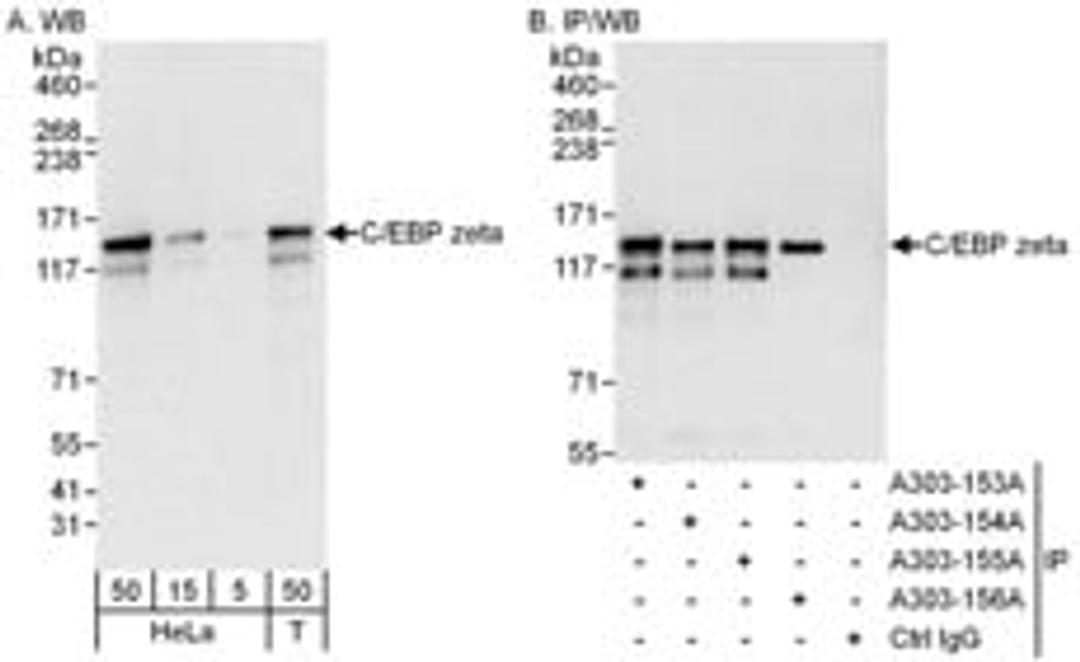 Detection of human C/EBP zeta by western blot and immunoprecipitation.