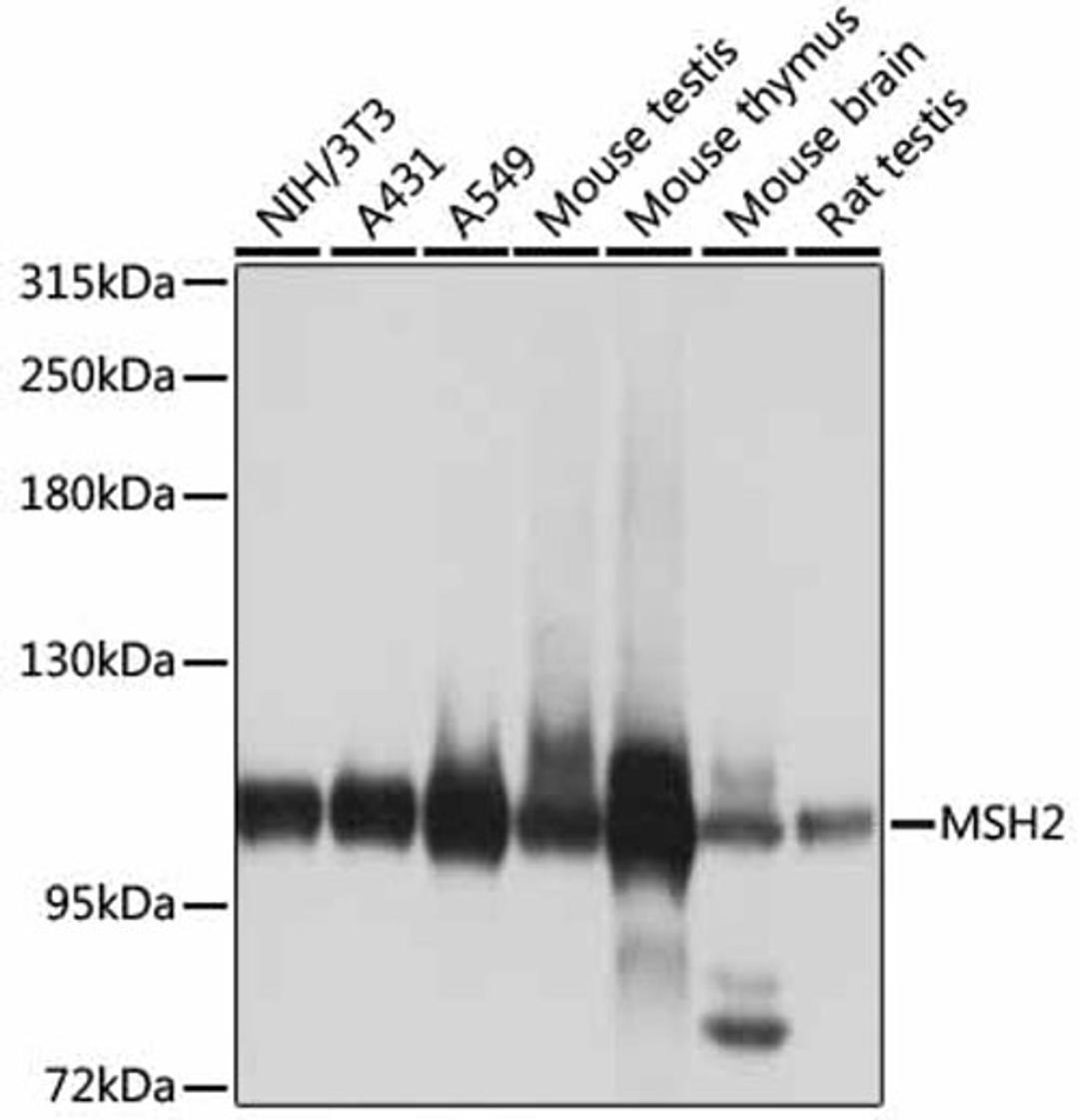 Western blot - MSH2 antibody (A1121)