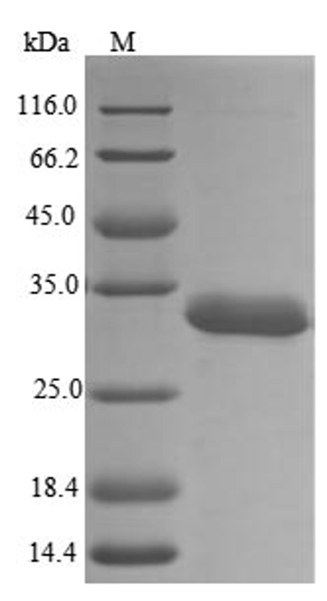 (Tris-Glycine gel) Discontinuous SDS-PAGE (reduced) with 5% enrichment gel and 15% separation gel.