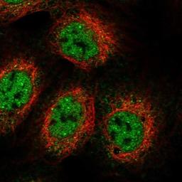 Immunocytochemistry/Immunofluorescence: CCDC83 Antibody [NBP1-83444] - Staining of human cell line A-431 shows positivity in nucleus but not nucleoli & cytoplasm.