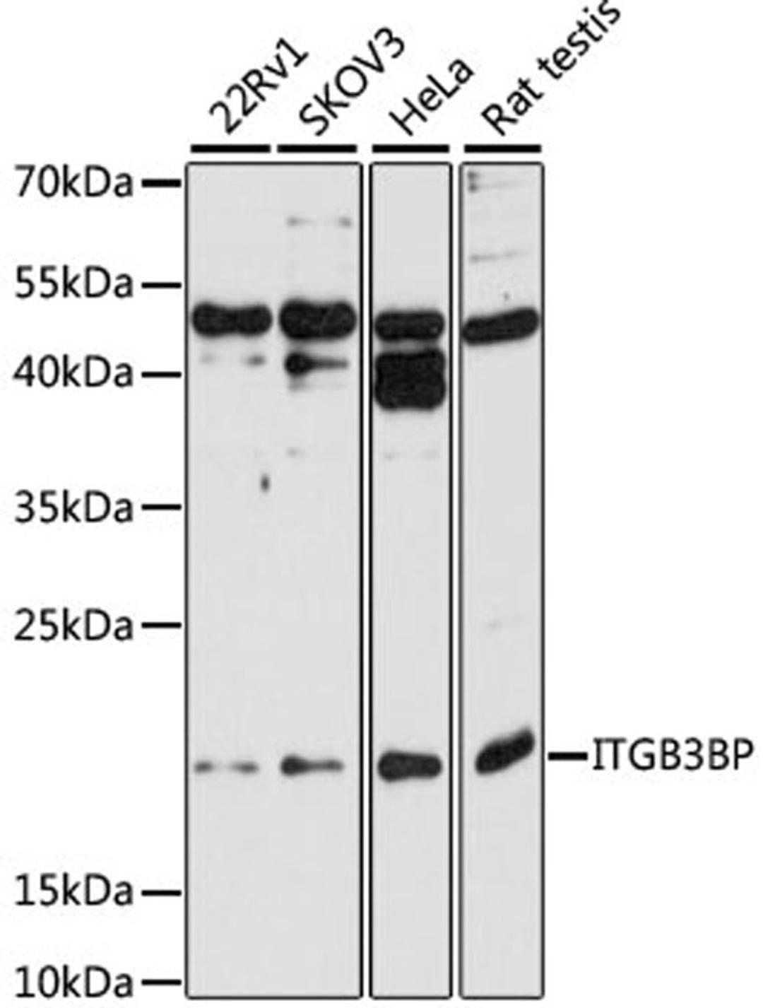 Western blot - ITGB3BP antibody (A5839)