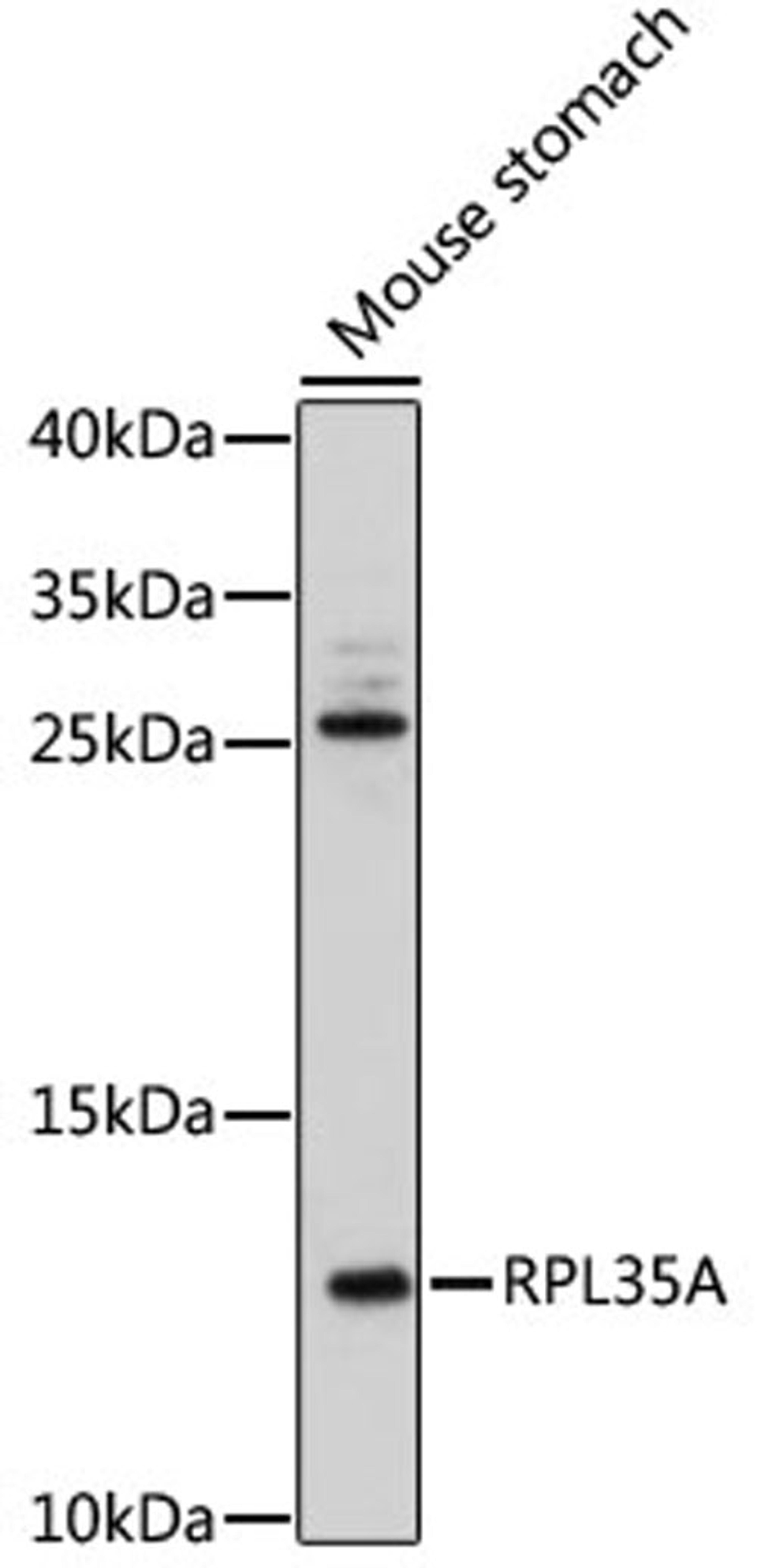 Western blot - RPL35A antibody (A17938)