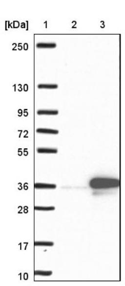 Western Blot: Dlx1 Antibody [NBP1-91837] - Lane 1: Marker [kDa] 250, 130, 95, 72, 55, 36, 28, 17, 10<br/>Lane 2: Negative control (vector only transfected HEK293T lysate)<br/>Lane 3: Over-expression lysate (Co-expressed with a C-terminal myc-DDK tag (~3.1 kDa) in mammalian HEK293T cells, LY406033)