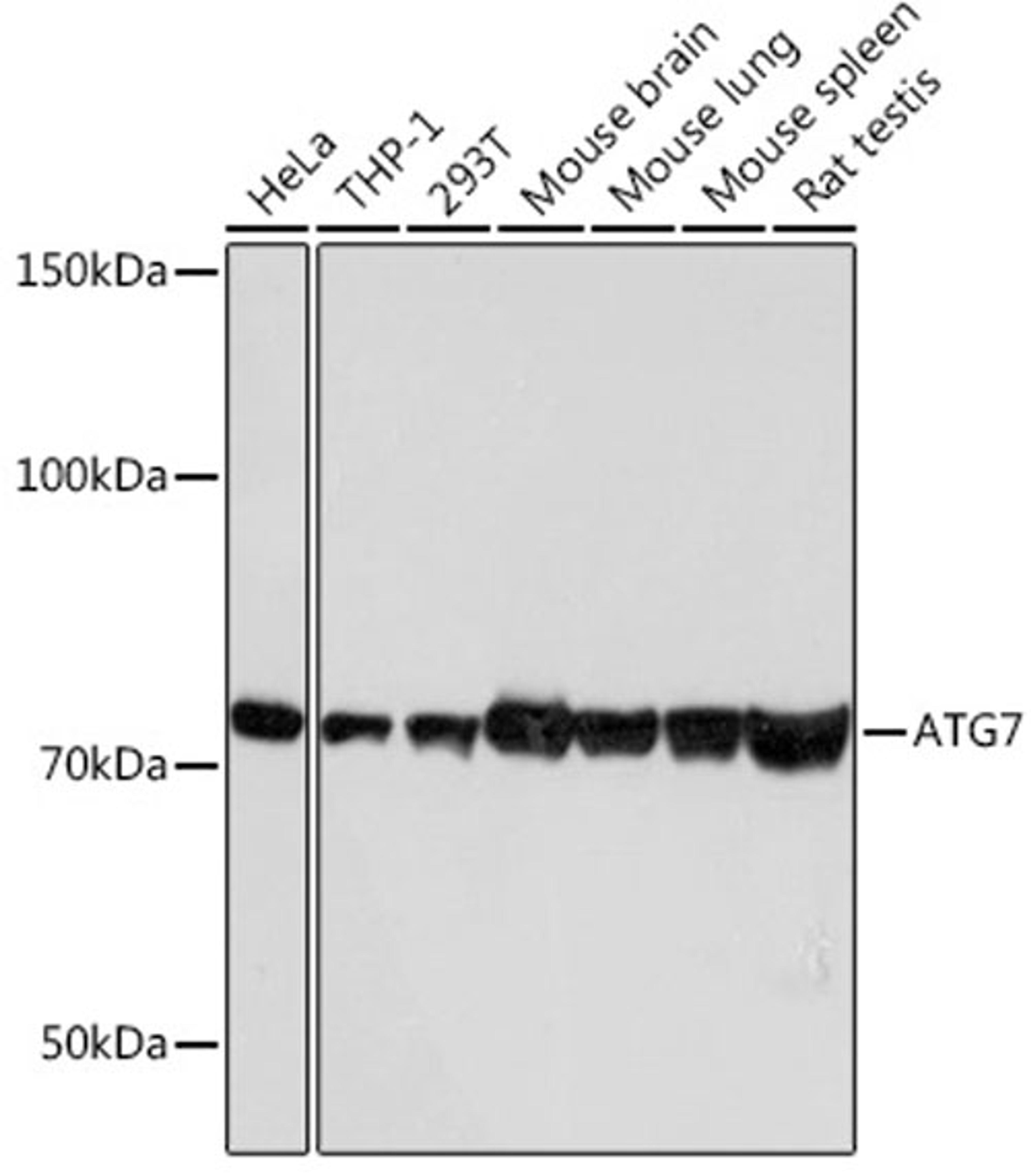 Western blot - ATG7 antibody (A19604)