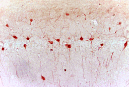 Immunohistochemical staining of paraffin embedded mouse hippocampus tissue