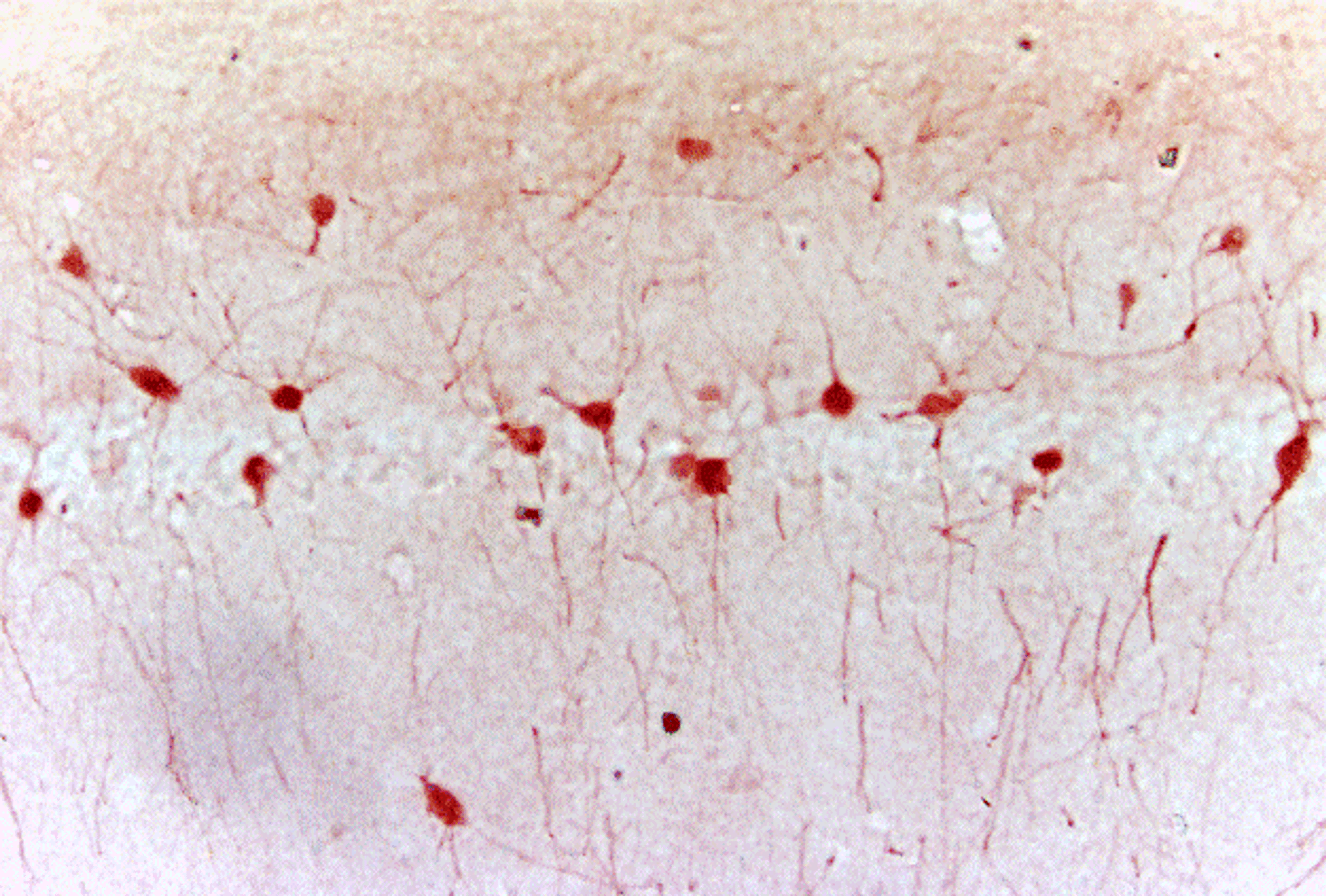 Immunohistochemical staining of paraffin embedded mouse hippocampus tissue