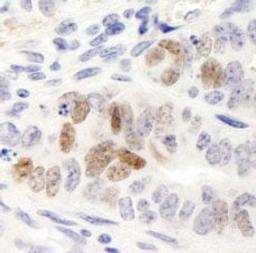 Detection of mouse Nanog by immunohistochemistry.