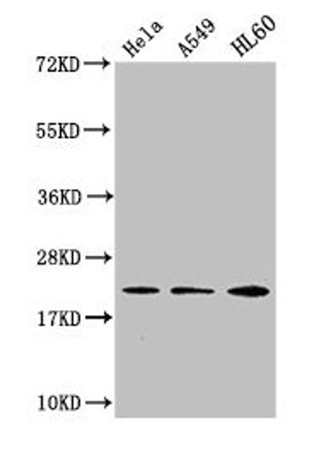 Western Blot. Positive WB detected in: Hela whole cell lysate, A549 whole cell lysate, HL60 whole cell lysate. All lanes: HIST1H1C antibody at 1:500. Secondary. Goat polyclonal to rabbit IgG at 1/40000 dilution. Predicted band size: 22 kDa. Observed band size: 22 kDa