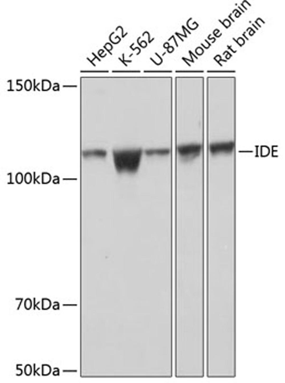 Western blot - IDE Rabbit mAb (A11190)