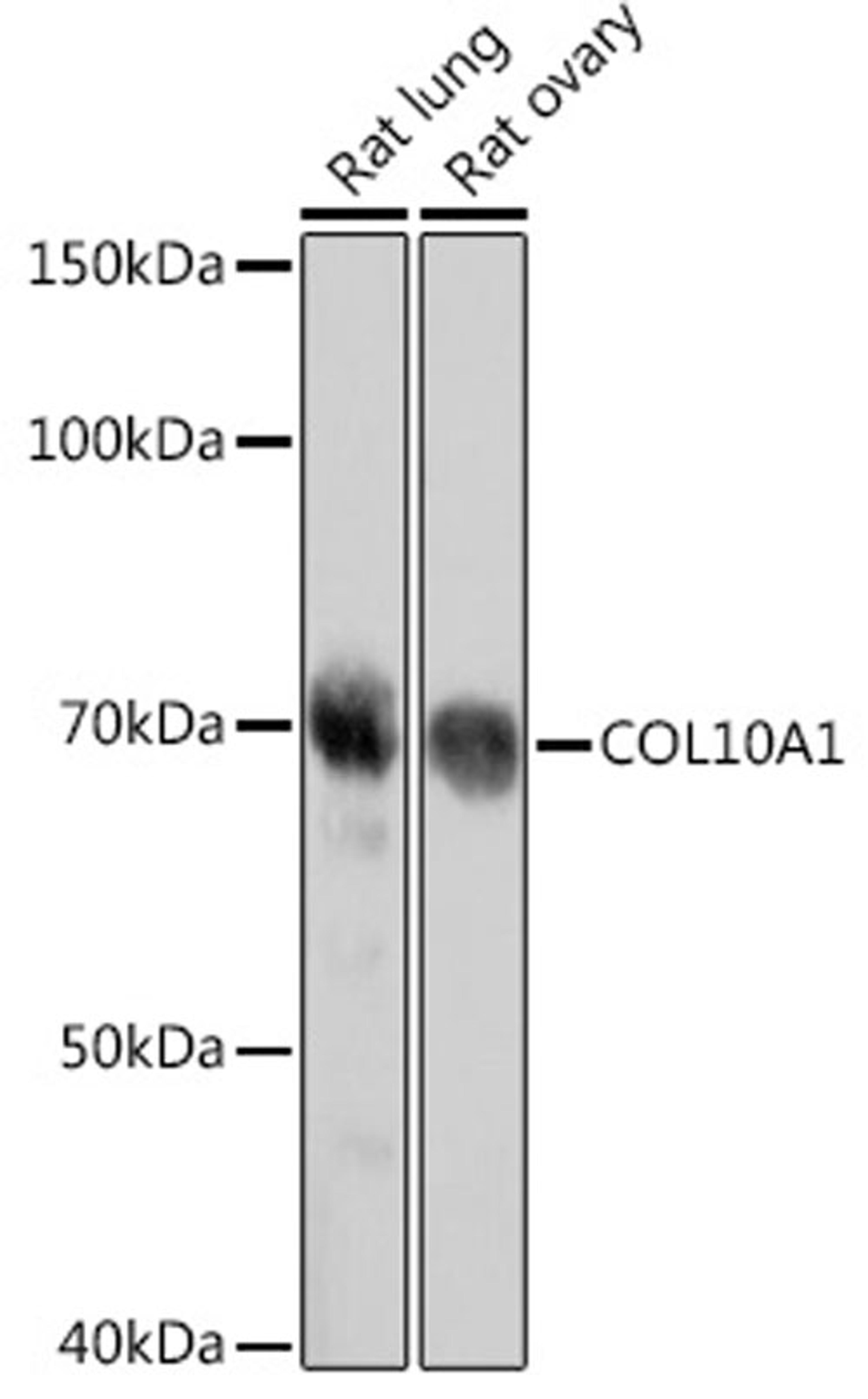 Western blot - COL10A1 antibody (A18604)