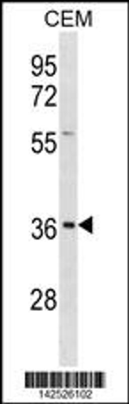 Western blot analysis in CEM cell line lysates (35ug/lane).