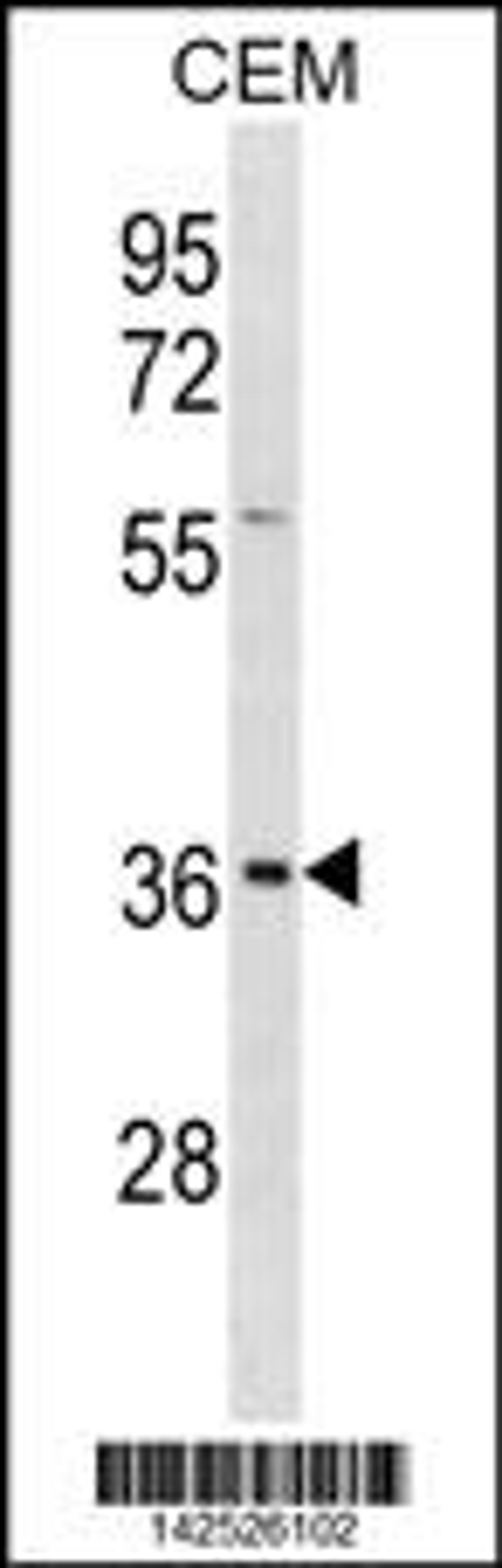 Western blot analysis in CEM cell line lysates (35ug/lane).