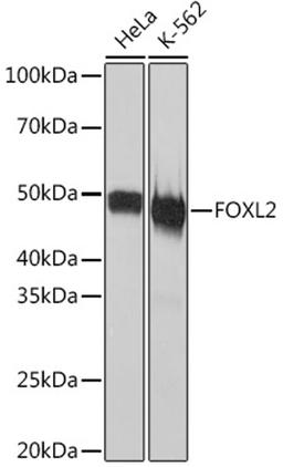 Western blot - FOXL2 Rabbit mAb (A3597)
