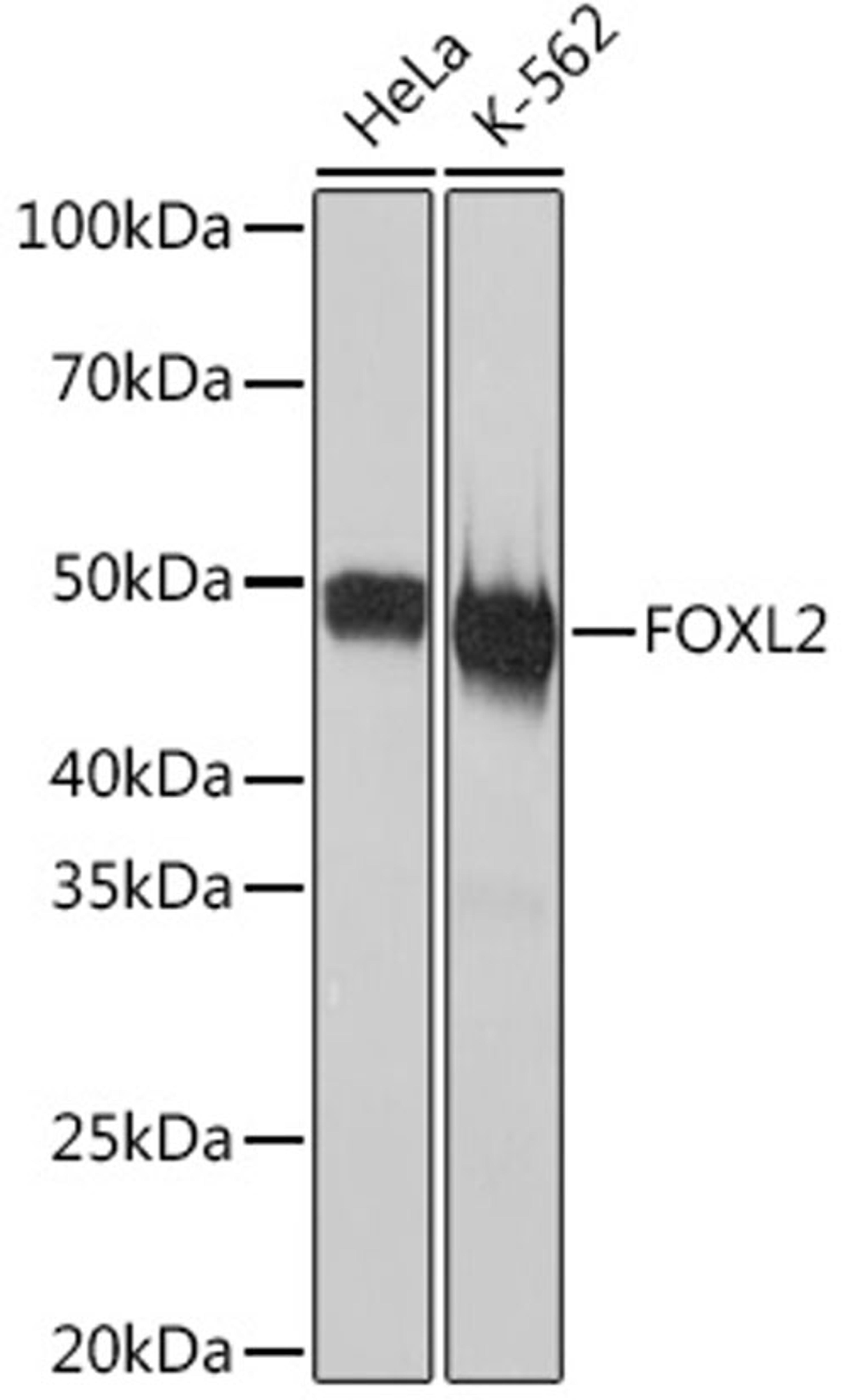Western blot - FOXL2 Rabbit mAb (A3597)