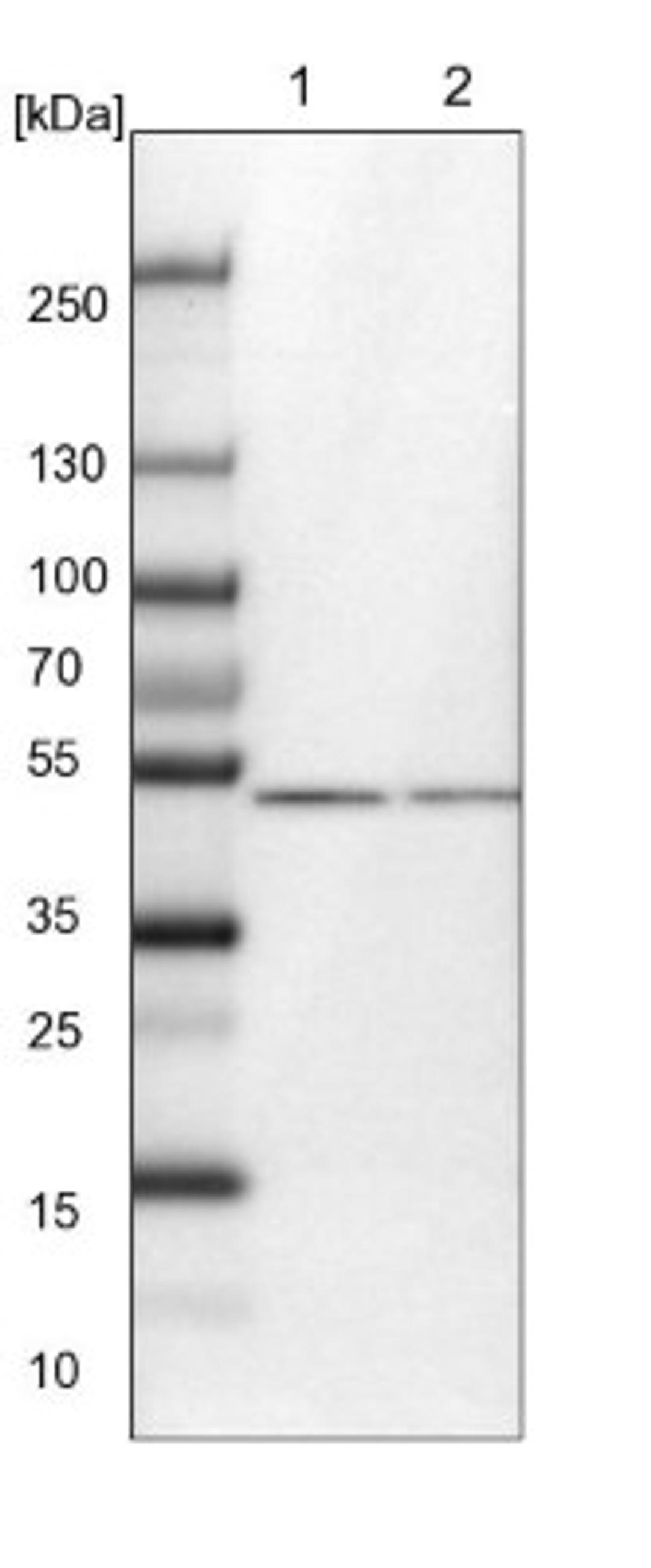 Western Blot: CDR2L Antibody [NBP1-93681] - Lane 1: NIH-3T3 cell lysate (Mouse embryonic fibroblast cells)<br/>Lane 2: NBT-II cell lysate (Rat Wistar bladder tumour cells)