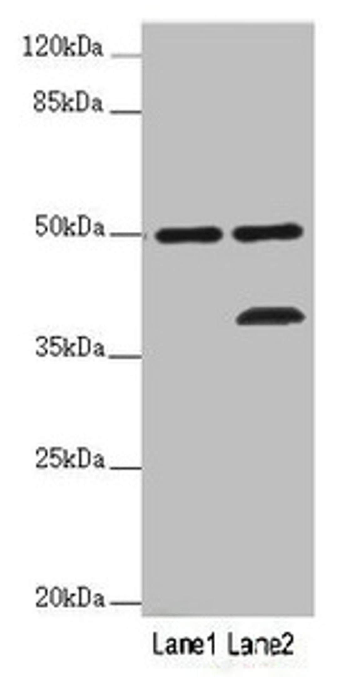 Western blot. All lanes: PLIN5 antibody at 2 ug/ml. Lane 1: Mouse kidney tissue. Lane 2: Mouse brain tissue. Secondary. Goat polyclonal to rabbit IgG at 1/10000 dilution. Predicted band size: 51 kDa. Observed band size: 51, 36 kDa. 