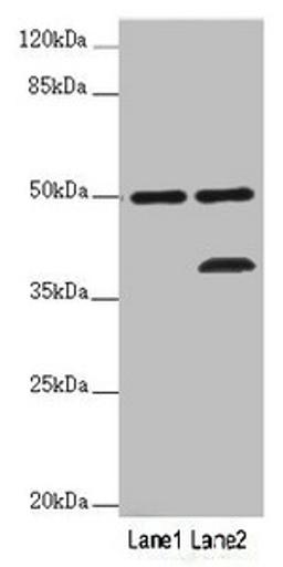 Western blot. All lanes: PLIN5 antibody at 2 ug/ml. Lane 1: Mouse kidney tissue. Lane 2: Mouse brain tissue. Secondary. Goat polyclonal to rabbit IgG at 1/10000 dilution. Predicted band size: 51 kDa. Observed band size: 51, 36 kDa. 