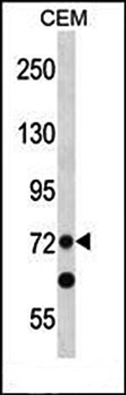 Western blot analysis of CEM cell line lysates (35ug/lane) using PRDM8 (N-term) antibody