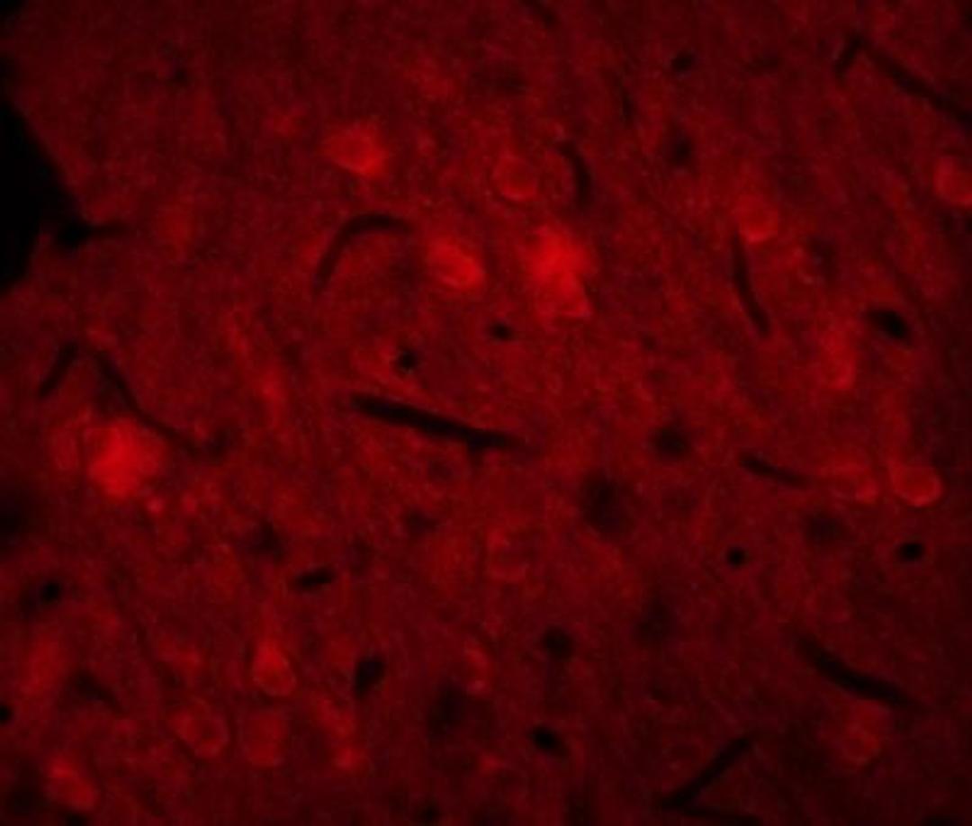 Immunofluorescence analysis of rat brain tissue using CD11b antibody.