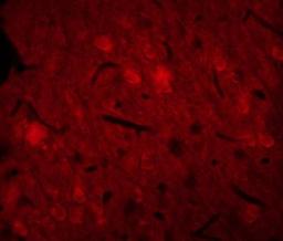 Immunofluorescence analysis of rat brain tissue using CD11b antibody.