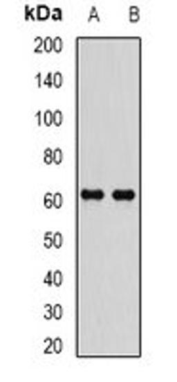 Western blot analysis of MCF7 (Lane1), Jurkat (Lane2) whole cell lysates using EPHX2 antibody