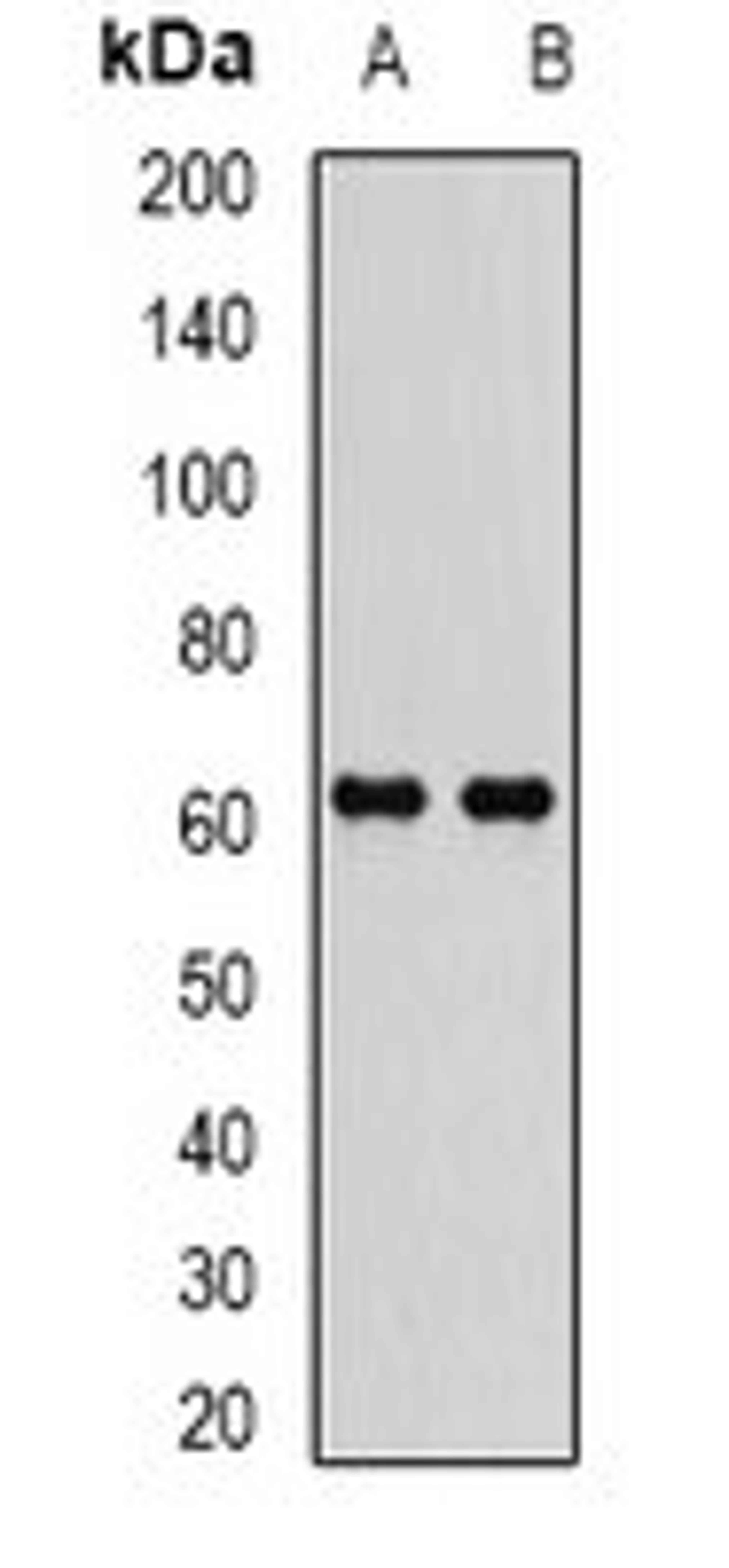 Western blot analysis of MCF7 (Lane1), Jurkat (Lane2) whole cell lysates using EPHX2 antibody