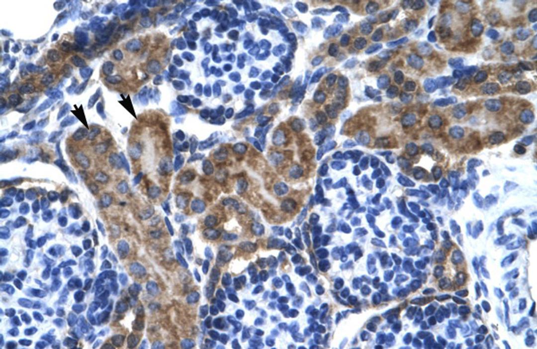 Antibody used in IHC on Human kidney.