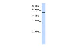 Antibody used in WB on Transfected 293T at 0.2-1 ug/ml.