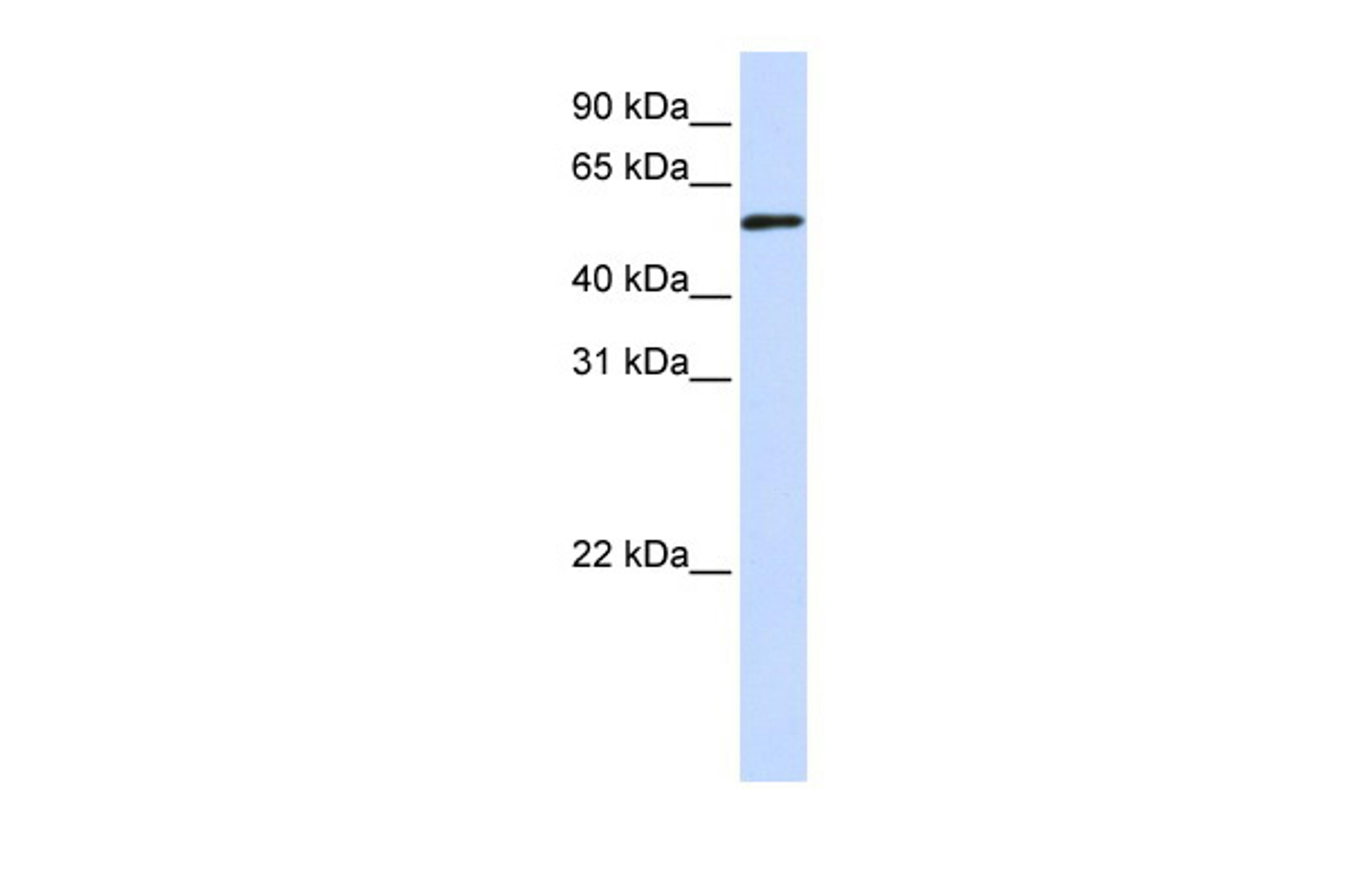 Antibody used in WB on Transfected 293T at 0.2-1 ug/ml.