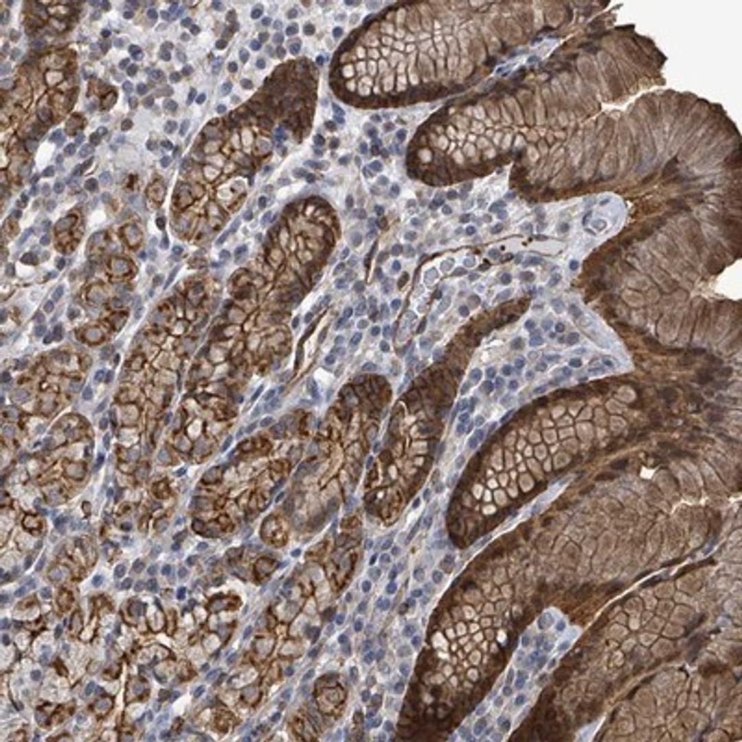 Immunohistochemistry-Paraffin: PRKRIP1 Antibody [NBP2-13811] - Staining of human stomach, upper shows strong cytoplasmic and membranous positivity in glandular cells.