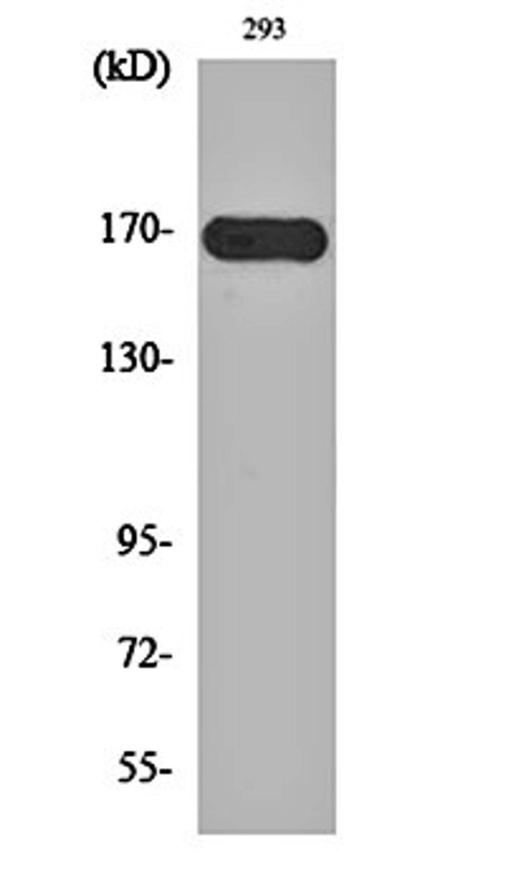 Western blot analysis of 293 cell lysates using c-Fms antibody