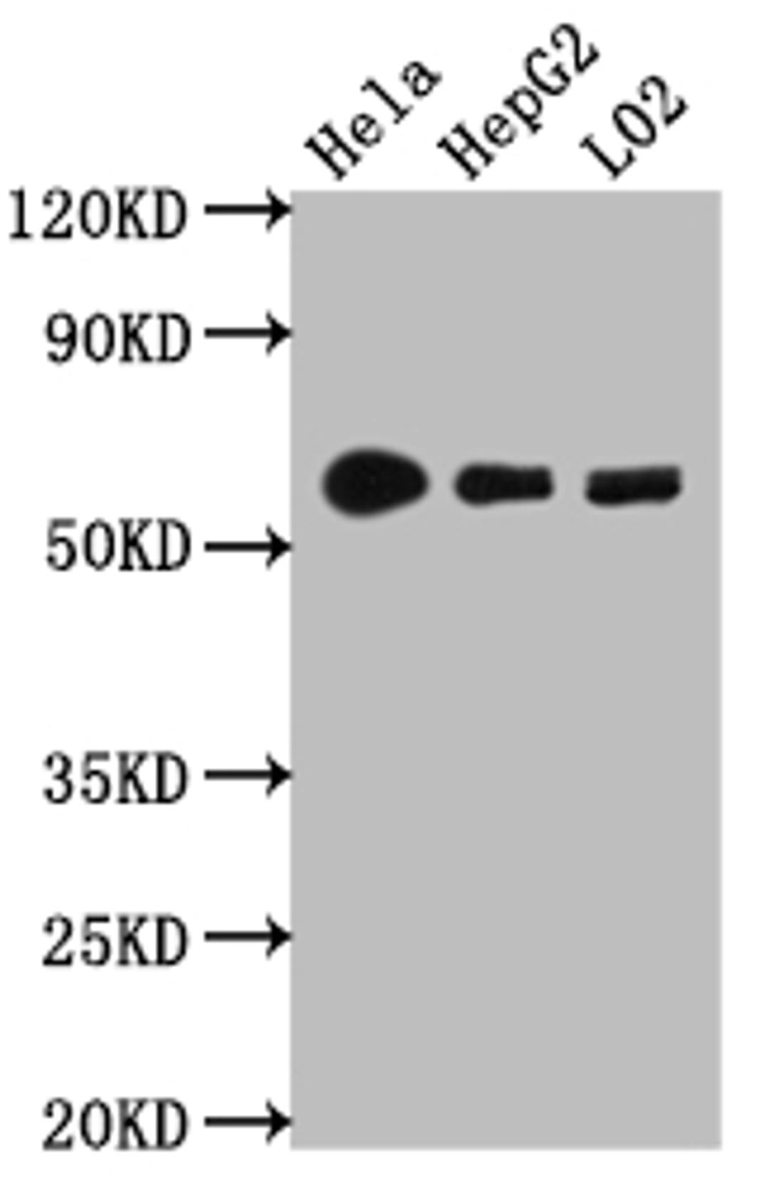 Western Blot. Positive WB detected in: Hela whole cell lysate, HepG2 whole cell lysate, L02 whole cell lysate. All lanes: CYP1A2 antibody at 1:1000. Secondary. Goat polyclonal to rabbit IgG at 1/50000 dilution. Predicted band size: 59 kDa. Observed band size: 59 kDa.
